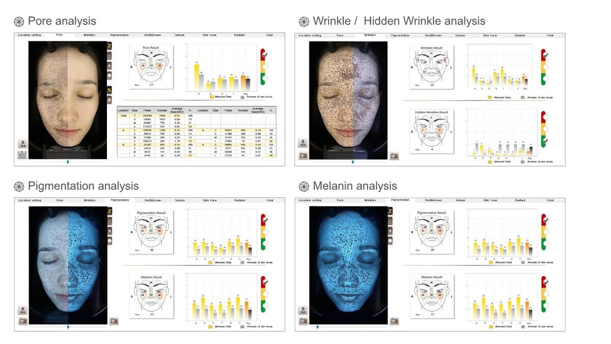 SkinScope Image 1