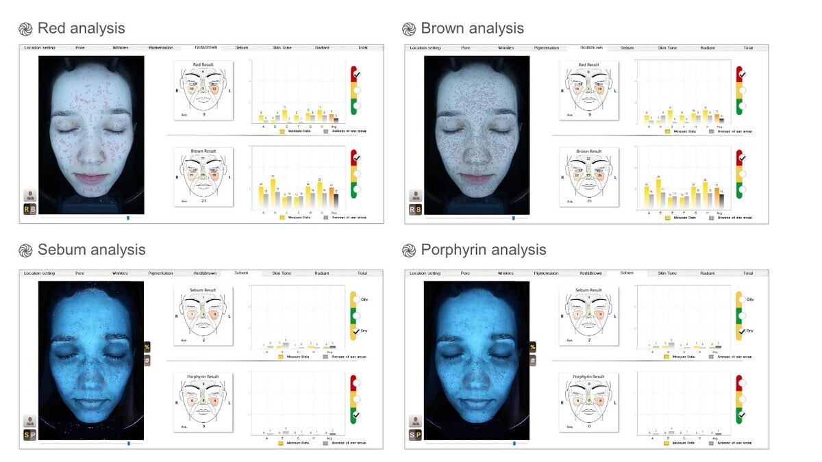 SkinScope Image 2